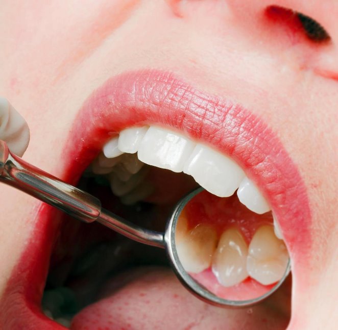 Diş hassasiyeti önlemleri