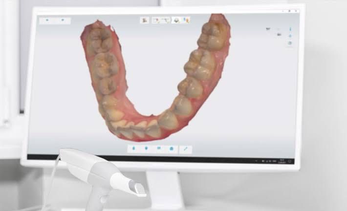 Denta ElAzığ Diş Kliniği CAD-CAM