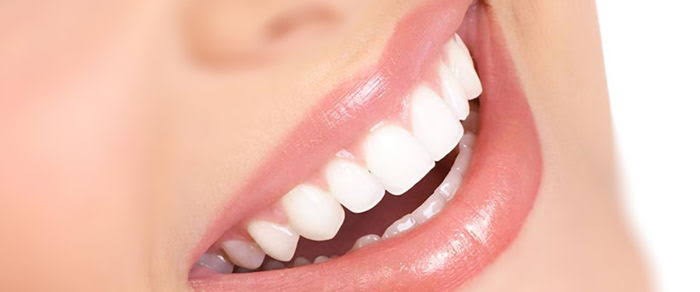 Gülüş Tasarımı (Hollywood Smile) Elazığ