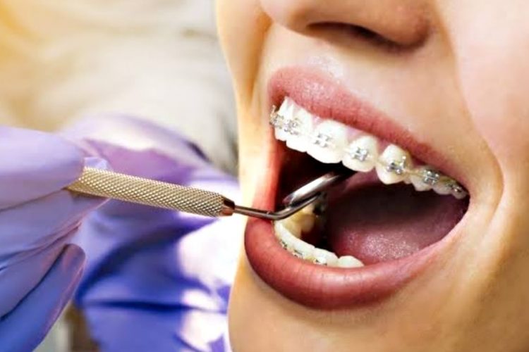 Ortodontik tedavi nedir?